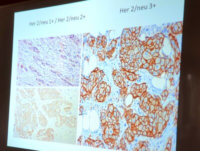Foto des Albums: Histologie erklärt! Zell- und Gewebeproben wichtig zur Klärung einer Krebsdiagnostik und Therapie