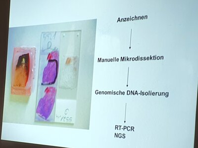 Foto des Albums: Histologie erklärt! Zell- und Gewebeproben wichtig zur Klärung einer Krebsdiagnostik und Therapie