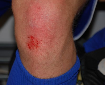 Foto des Albums: Eintracht Frankfurt gegen JFV Bad Hersfeld e.V.   U14