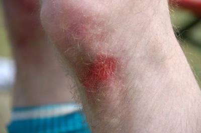 Foto des Albums: Marktmeisterschaft 2008