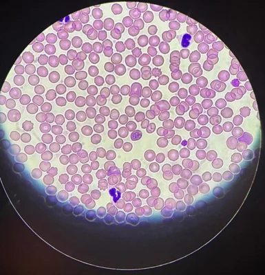 Vorschaubild: Hundemalaria im Ausstrich