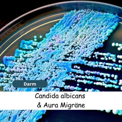 Meldung: Candida albicans Pilze können Aura Migräne auslösen