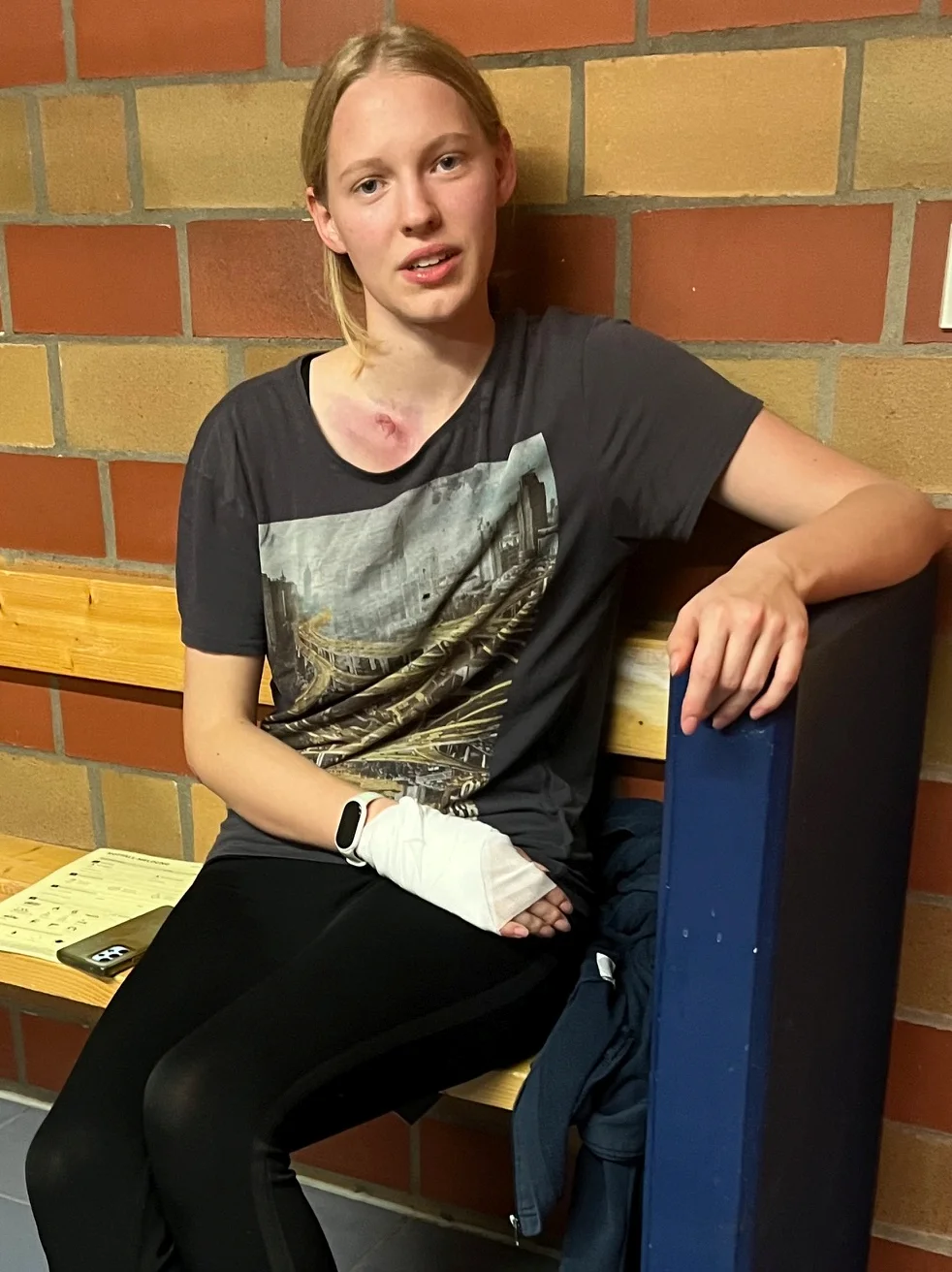 Täuschend echt waren die Verletzungen der Statisten geschminkt. Foto: Birgit Mittwoch