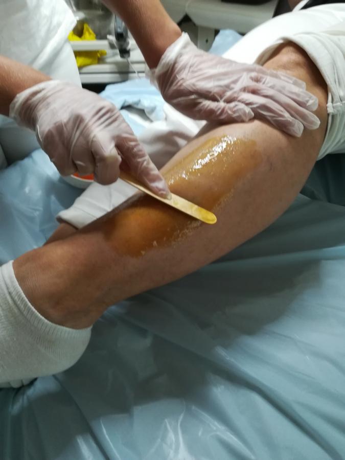 Sugaring Sugaring